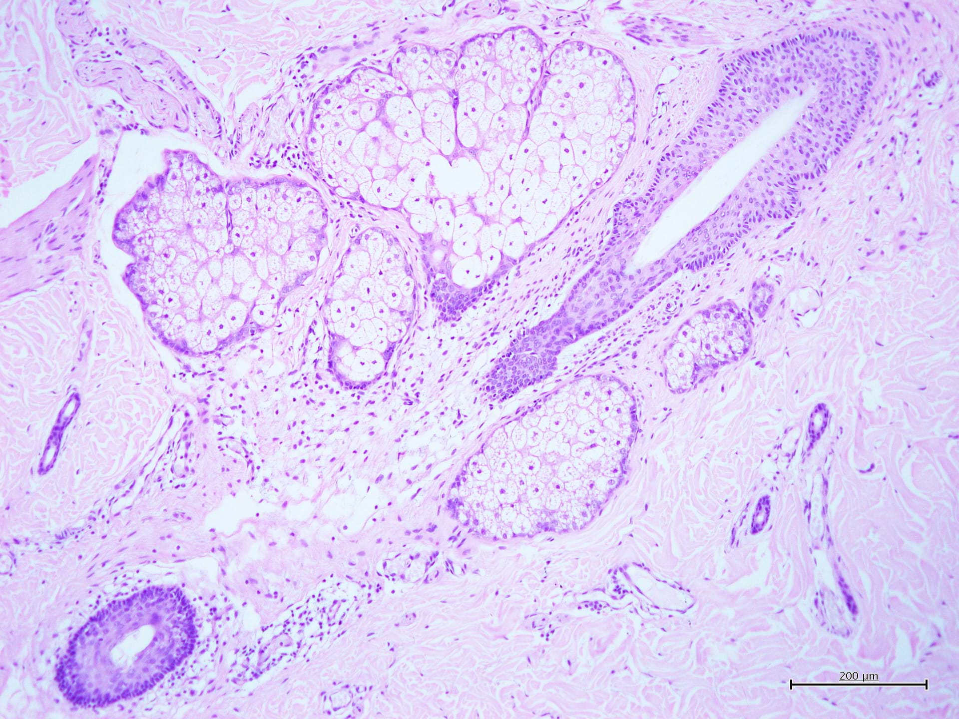 Carazzi<br />hematoxylin