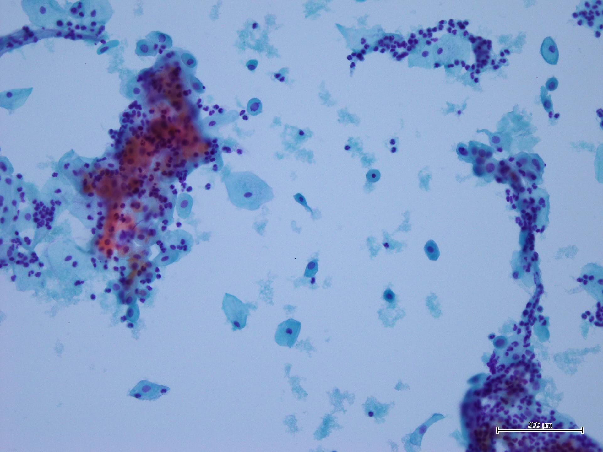 Cytopath Harris hematoxylin