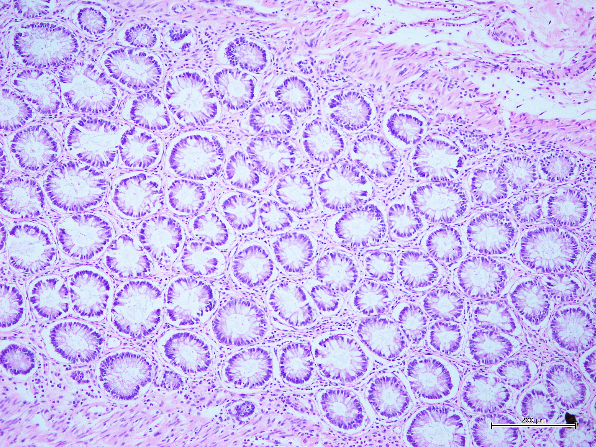 Harris for<br />histology