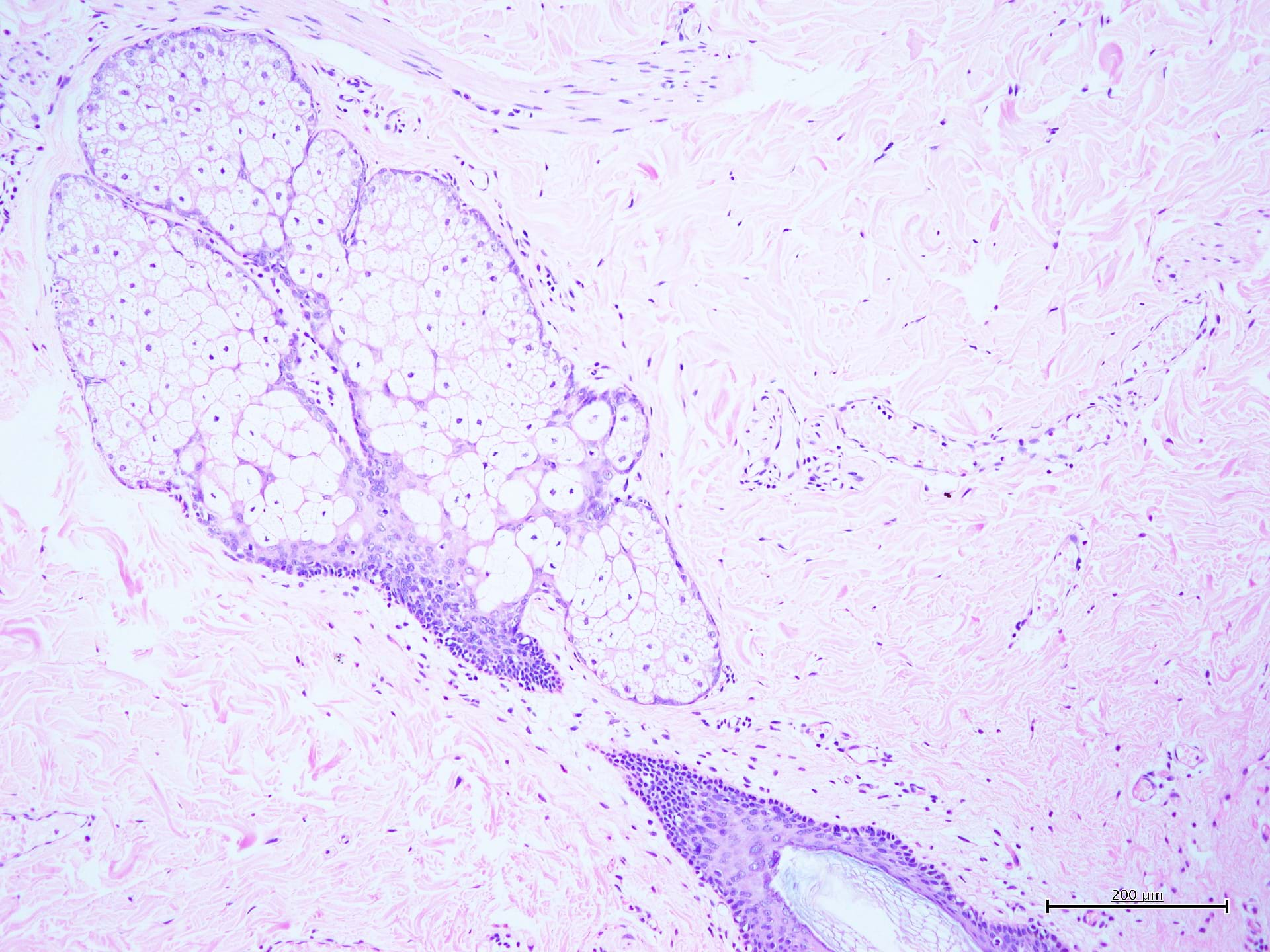 Mayer<br />hematoxylin