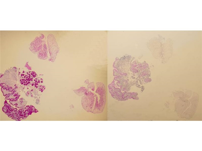 Diastase buffer