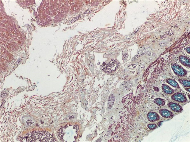 Movat pentachrome staining