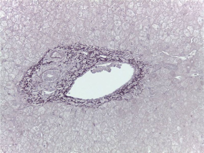 Acid orcein 