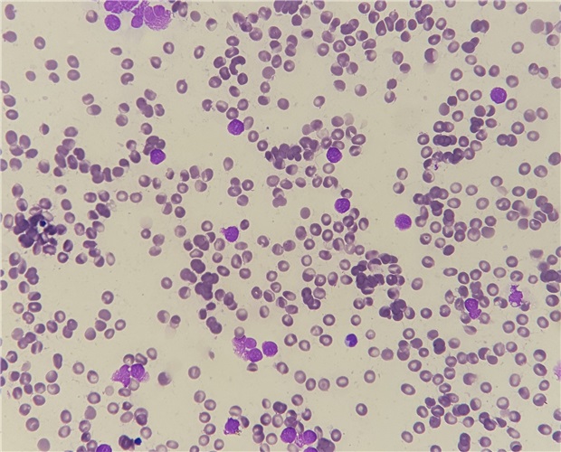 May - Grunwald Giemsa for smears kit