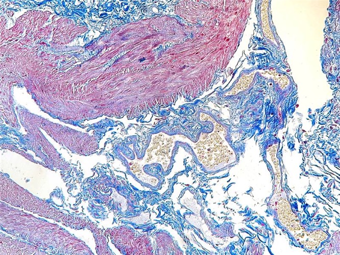 Masson's trichrome