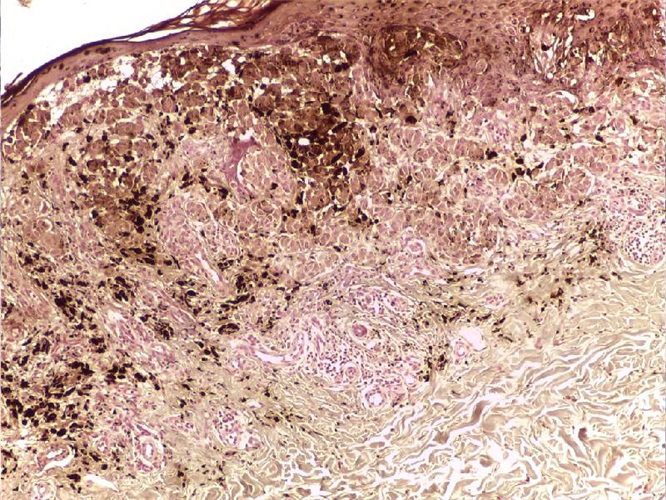 Masson Fontana per microonde