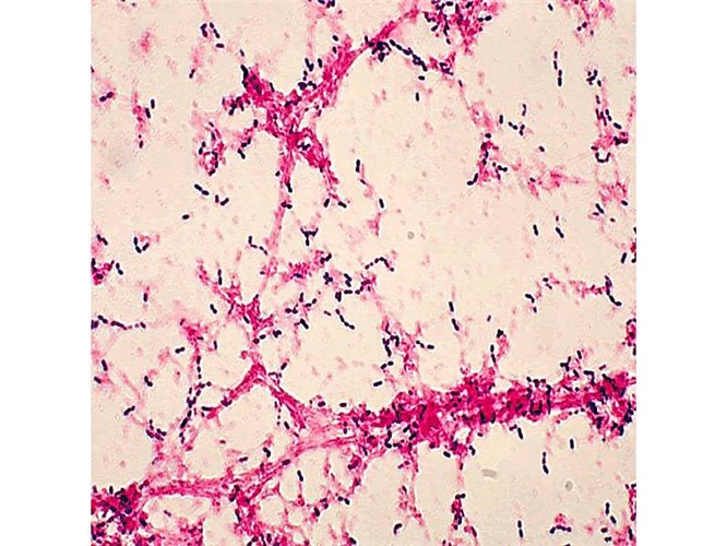 Gram for microbiology (with basic fuchsin) 