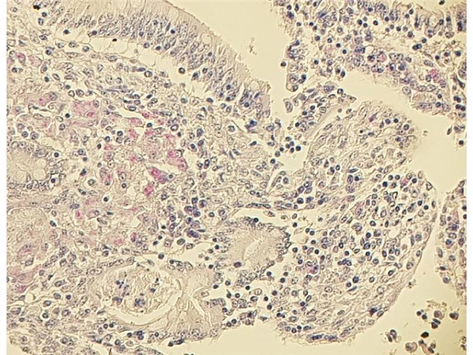 Acid fast Bacteria acc. Ziehl-Neelsen - Tiziano Stainer