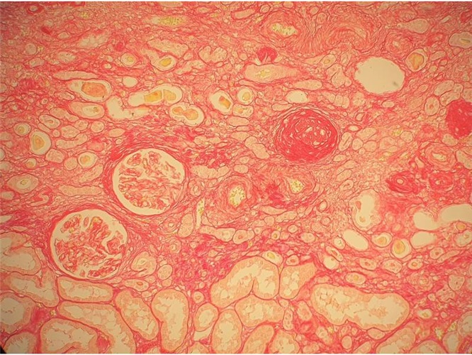 Sirius Red for collagen - Tiziano Stainer