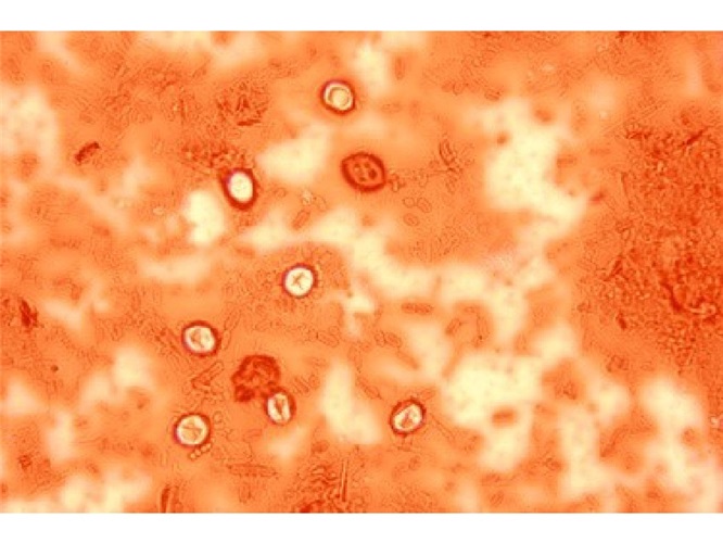 Staining with Merbromin