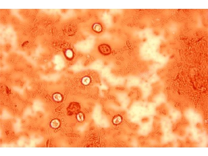 Staining with Merbromin