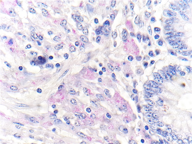 Acid Fast Bacteria acc. to Ziehl Neelsen 