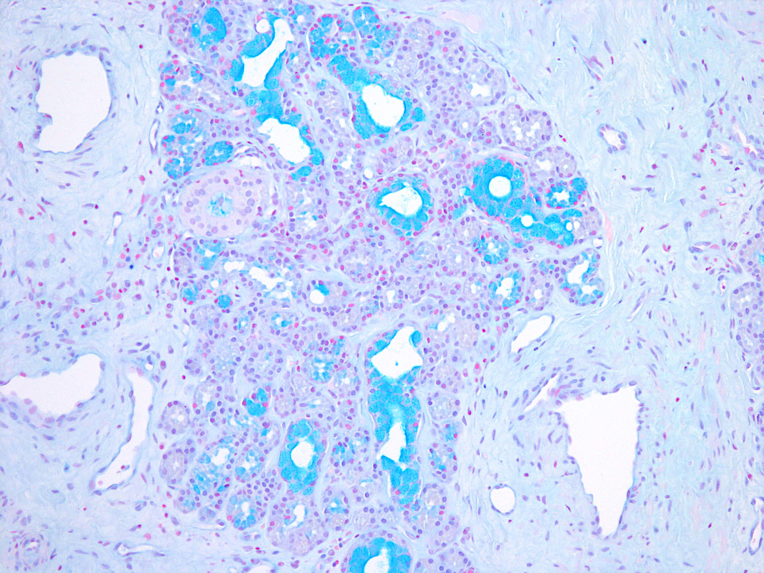 Cristallo, Liquid Coverslipping for Histological Slides