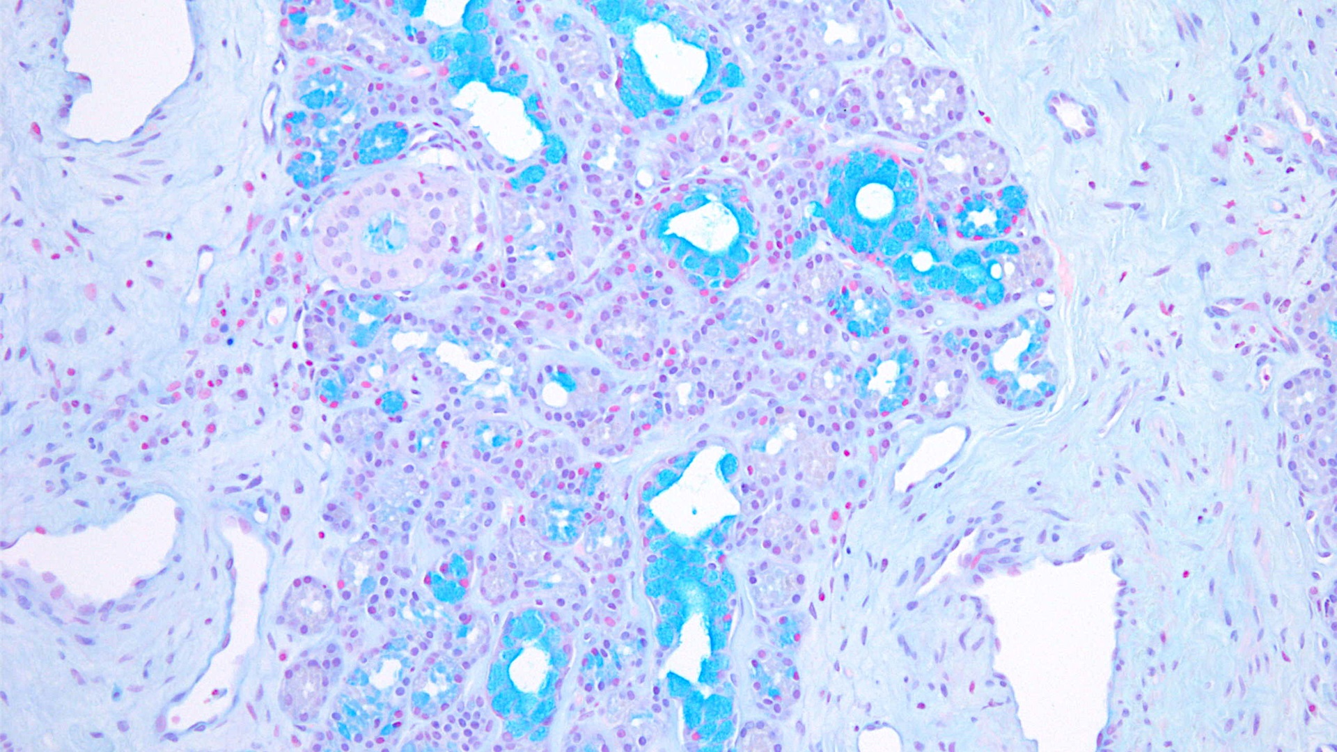 does squamous cell carcinoma spread quickly